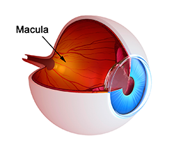Macular support